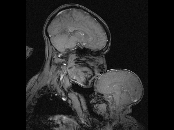 어머니와 아기의 MRI 사진(레베카 색스 등, MIT)
